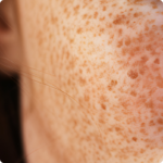 Cytolnat® Kojic - Image 2